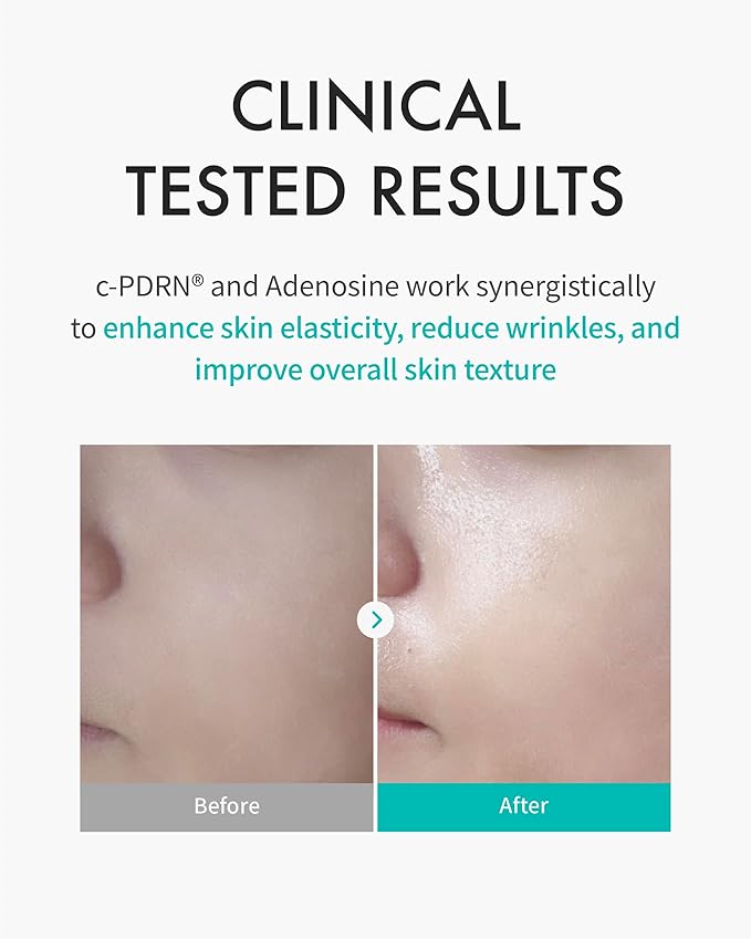 REJURAN® Turnover Mask, c-PDRN® (5ea) – Original Salmon DNA for Firming, Hydration, Repairing & Revitalizing. Achieve Youthful, Radiant Skin. Korean Skincare. Ultra Microfiber Sheet Mask