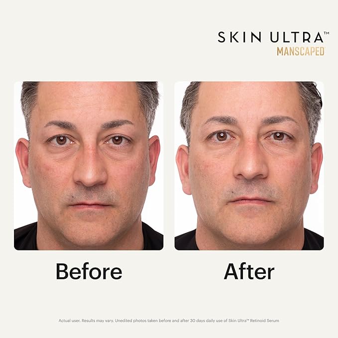 MANSCAPED® Skin Ultra™ Retinoid Serum - Dual Retinoid Age-Defying Formula with Squalane, Ceramides & Hyaluronic Acid to help Reduce Appearance of Fine Lines, Wrinkles & Dark Spots, 1 fl oz.