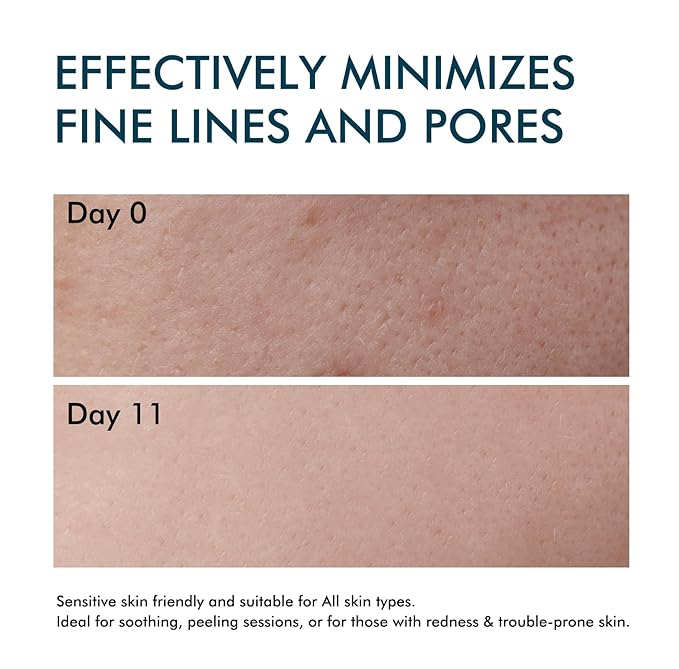 Stem Cell Serum for Face, Effective Microneedling Serum, Advanced Age-Defying Formula for Wrinkle Reduction & Skin Renewal- Daily Skincare Use with and Without Microneedling, 1.2 Fl Oz