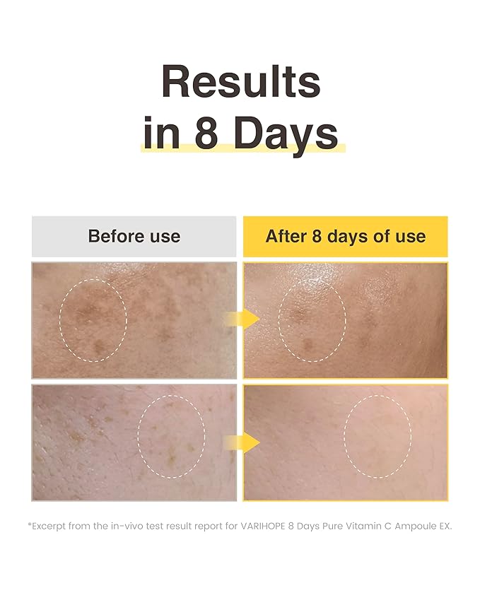 VARIHOPE 8 Days Vitamin C Serum - High-Potency Ascorbic Acid for Brightening, Dark Spot Care & Even Skin Tone, Korean Skin Care Ampoule for Glowing, Radiant Skin, 0.5 fl oz