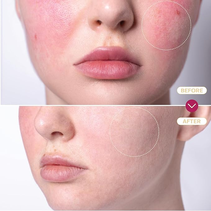 BASE LABORATORIES Hypochlorous Acid Spray for Face & Skin | 8 oz | Facial Spray Daily Skin Repair Solution for Sensitive Skin, Redness, Irritations, Eczema, Acne. Hypochlrous HOCL Molecule Spray