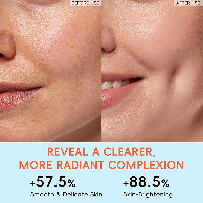 Citrus Vitamin C Skin Care Set, K-Beauty Skincare for Women Teens Girls- Gift Set with Cleanser, Toner, Eye Cream, Moisturizer, Facial Mask *2, Facial Skincare Product, Travel Set, for Oil Skin Type