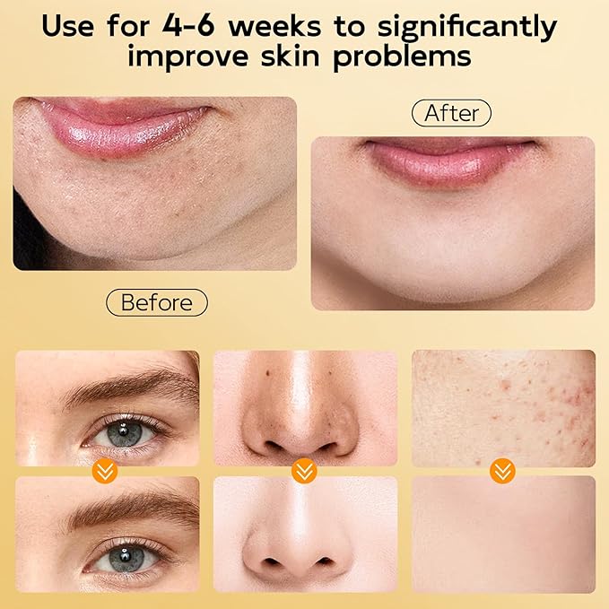 4 in 1 Bubble Turmeric Face Wash - Turmeric Kojic Acid Foaming Face Cleanser - Exfoliation Deep Cleansing of Facial Skin - Suitable for Sensitive & Acne Skin - 3.38 fl.oz