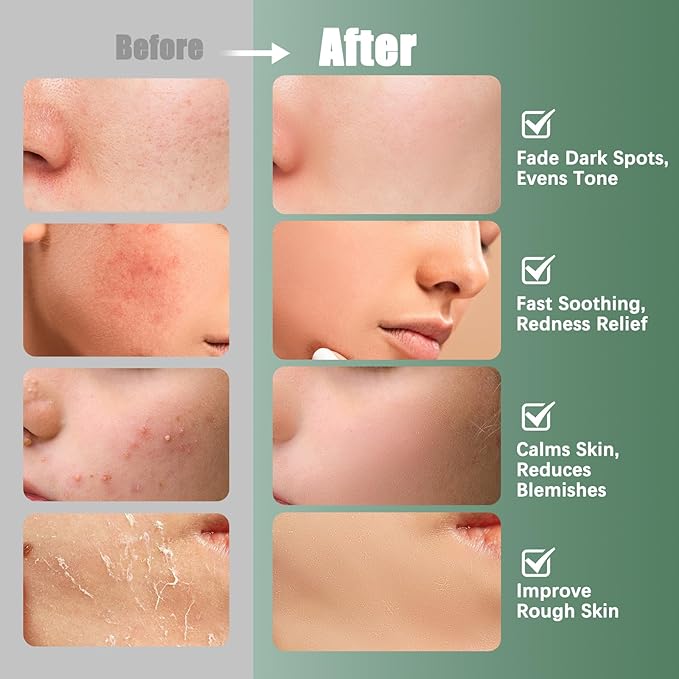 Madecassoside Toner Pads | 110 Pad Calming Face Pads with Centella Asiatica to Soothe,Balance Skin Tone,Fades Blemishes & Spots | Daily Face Skincare