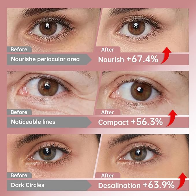 30 Pairs 3-Secs Melting Collagen Under Eye Patches with Vitamin C Serum, Under Eye Mask for Puffy eyes and Dark Circles | Retinol+Hyaluronic+Niacinamide+Ceramides,Korean Popular Eye Patches