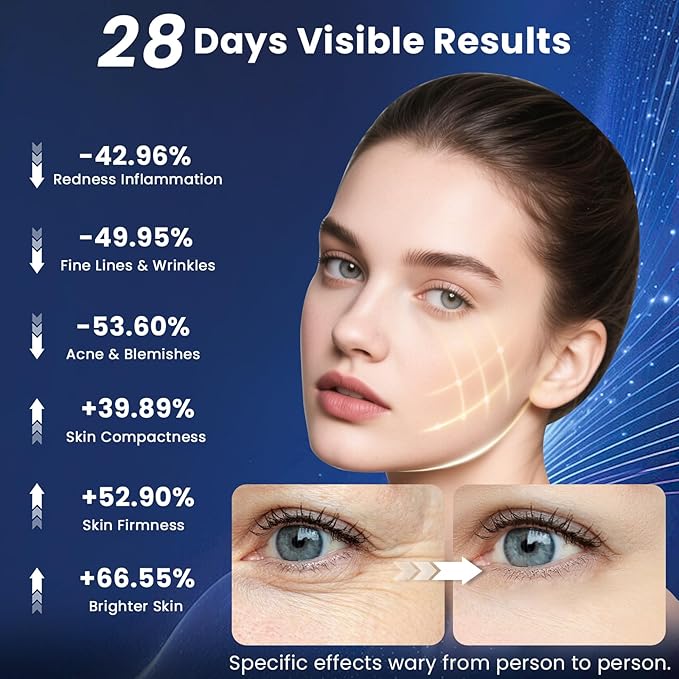 Red Light Therapy for Face – Wireless Red Light Therapy Mask LED Face Mask Light Therapy with 320 LEDs, 3 Modes, Skin Rejuvenation, Anti-Aging Skincare Ideal Beauty Gift for Women & Men