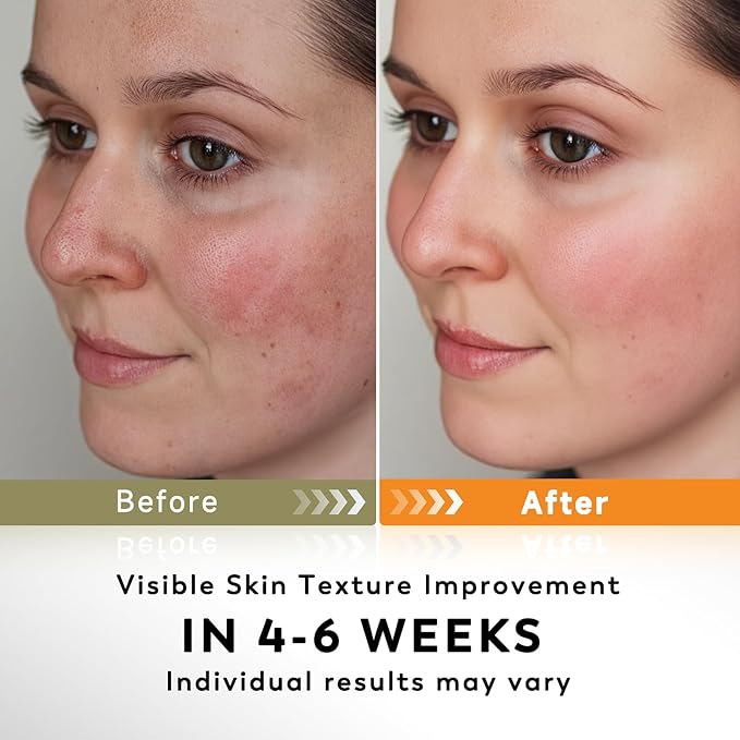 Turmeric Kojic Acid Cleansing Pads, 50 PCS Turmeric Pads for Face Dark Spots Cleansing & Exfoliation