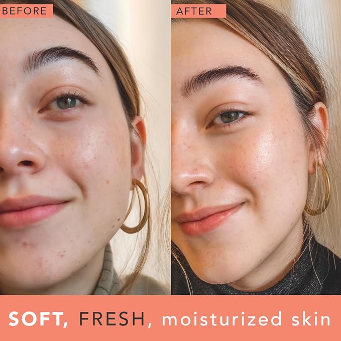 Rose Water Spray for Face - USA Made with Hydrating Natural & Organic Ingredients for Glowing Skin, Alcohol-Free Rosewater Toner Mist with Witch Hazel & Glycerin for Dry and Sensitive Skin