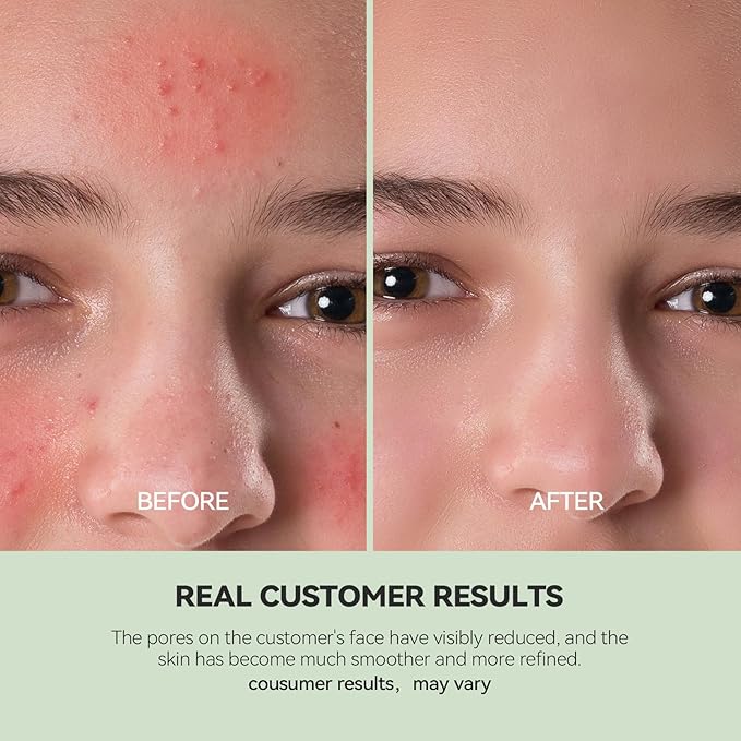 WNP Skincare Trio – Hyaluronic Acid Ampoules + Oil Suspension Serum + Dual Clay Mask for Deep Hydration, Barrier Repair, Oil Control & Pore Cleansing – For Dry & Sensitive Skin