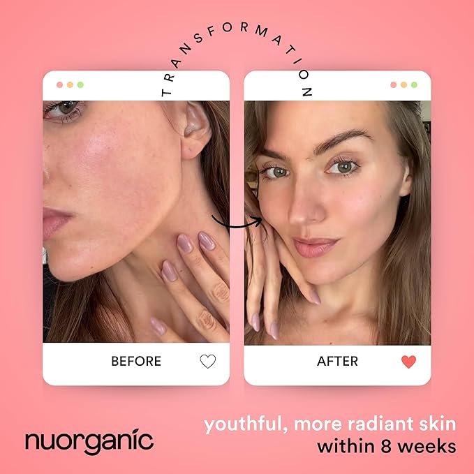 nuorganic 10% Niacinamide Serum with Plant Stem Cells - Replenishing Daily Skin Booster for More Raidant Youthful Glow - 1fl Oz 30ml