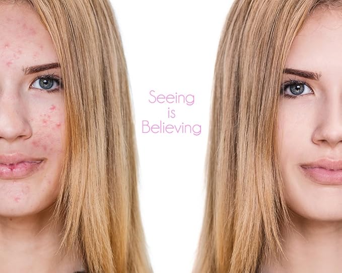 Dinair Airbrush Makeup Master Foundation Collection - Camouflage Neutralizer perfect to cover Scars, Acne, Tattoos, Under Eye Circles, Sun Spots, Vitiligo.