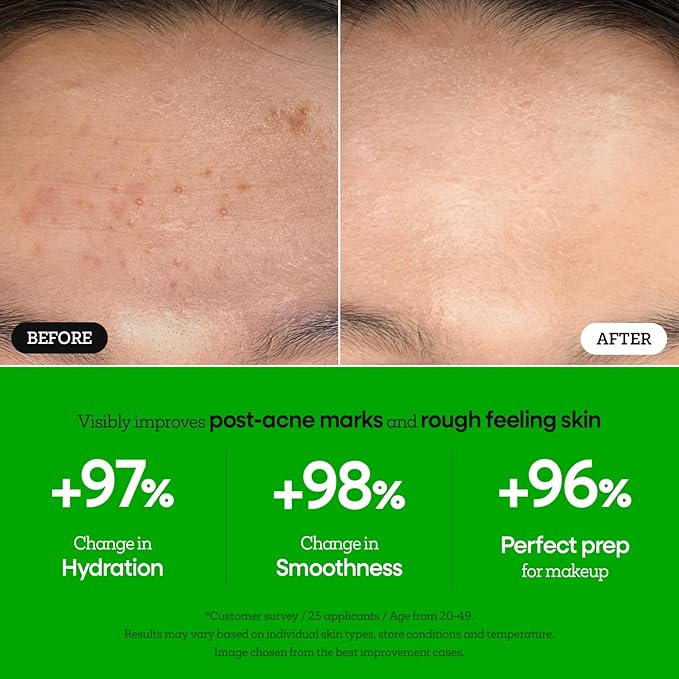 Nature Republic The First Peptide Boosting Serum – Niacinamide, Hyaluronic Acid, Hydrating & Firming Facial Serum, for Uneven Skin Tone, Korean Skincare, 150ml / 5.07 fl oz