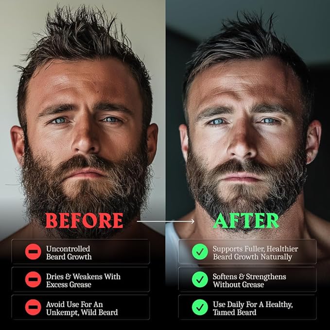 Striking Viking Beard Oil for Men - Naturally Derived Conditioner with Almond, Tea Tree, Argan & Jojoba Oil for Beard Growth, Softening & Moisturizing (2 Fl Oz (Pack of 1), Bergamot Thunder)