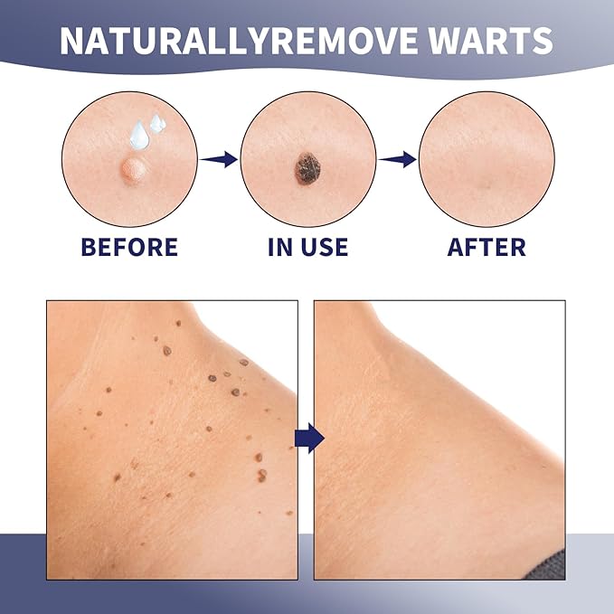 Natural Care Cream, Smoothes Skin, with Niacinamide & Licorice Root Extract, Lightweight, Fast-Absorbing, Daily Skincare Solution, 20g (1 Pcs)