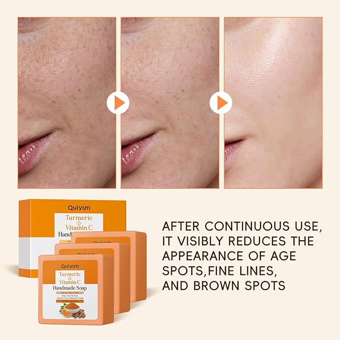 Natural Turmeric Soap Bar for Dark Spot- Vitamin C Dark Spot Remover for Face, Skin Care Sets, Facial Skin Care Products, Even Skin Tone, 3 Pack with African Net Sponge (3.53 Oz/Pcs)