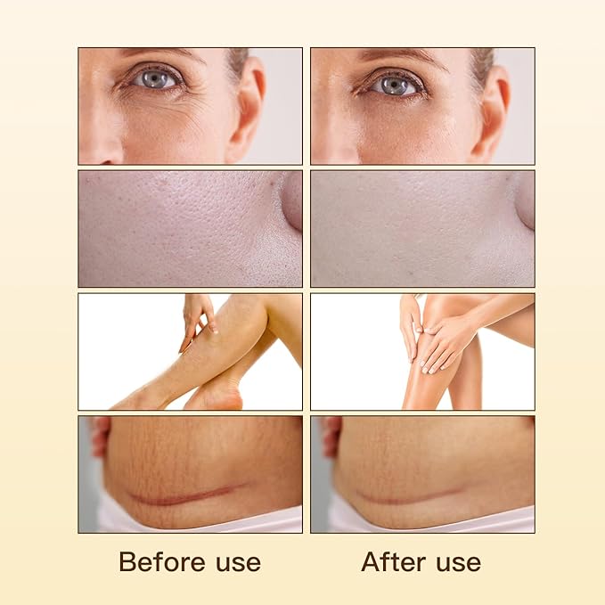 Organic Rosehip Oil, Facial Anti-Aging, Rosehip Oil for Face, for Scars, Natural Extraction of Bakuchiol, Moisturizing&Uniform Skin Tone, for all Skin Types- 30ML