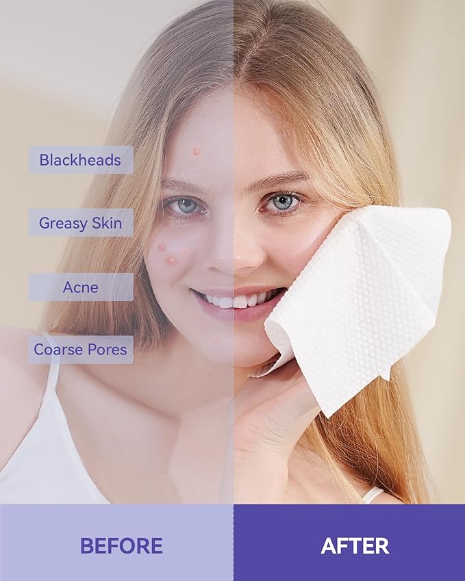 Face Towels Disposable, Face Towelette Disposable, Soft Disposable Face Towel for Makeup Remover, Thick Face Cloths for Women Cleansing, Skin Care, 7.8"×7.8", 80 Count (1 Pack)
