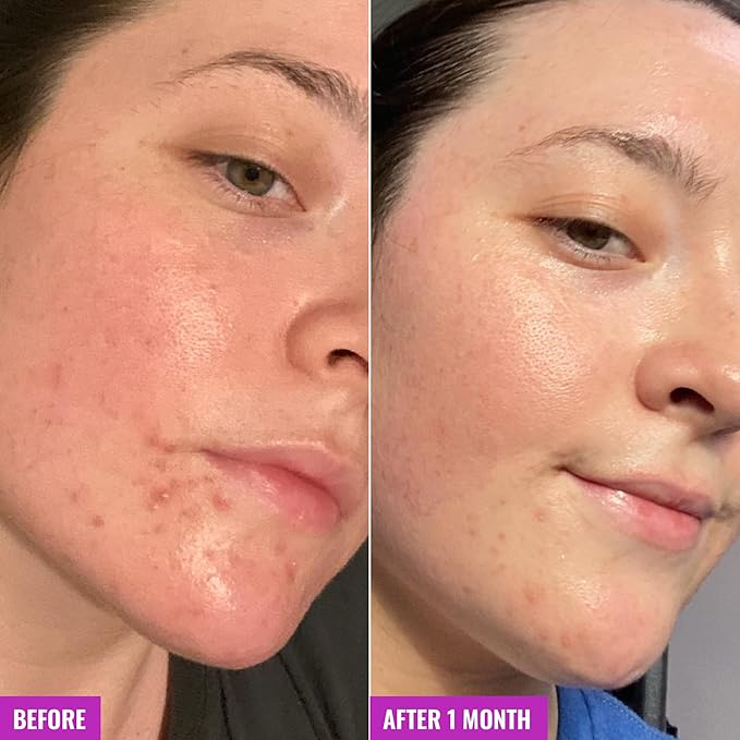 Good Molecules Clarify and Cleanse Bar - Soap Free Bar with Salicylic Acid, BHA for Skin Tone Balancing and Cleansing - Body and Facial Cleanser, Skin Care for Face (Pack of 2)