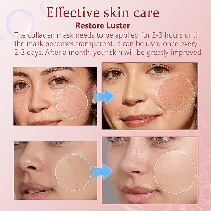 5PCS Bio-Collagen Face Mask, Collagen Mask Overnight, Hydrating Overnight Hydrogel Mask, Hydrating, Firming, Pore Minimizing, Elasticity Improvement, for All Skin Types, Christmas Gifts for Women
