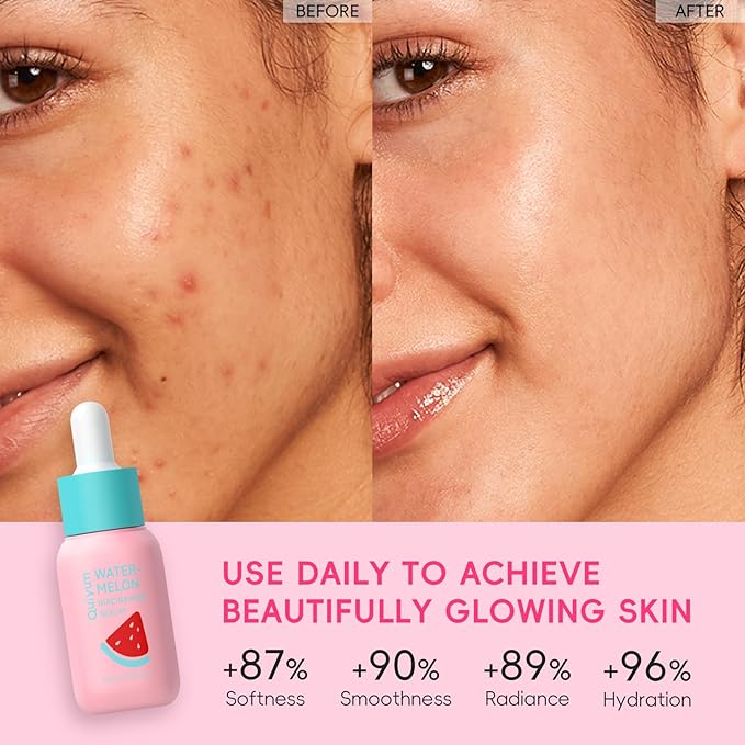 Niacinamide Serum for Face, Skin Care with Watermelon Extract & Hyaluronic Acid, Vitamin C, Hydrating, Glow, Anti-Aging, for Uneven Skin Tone, for Teens Girls Women Gifts, 1 Fl. Oz