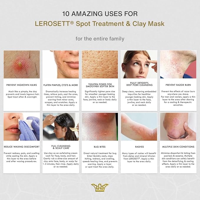LEROSETT Facial Clay Mask for Acne, Oily Skin, Visibly Tightens Pores. Overnight Spot Treatment for Pimples, Blemishes, Cysts, Blackheads. 100% Natural, Spa-Grade, Made in Sweden Since 1987