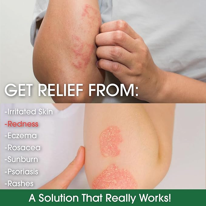 Green Leaf Naturals - Manuka Honey Face Cream - 8oz -Aloe Vera - Jojoba Oil Infused - Body Cream - Gluten Free Moisturizer for Kids & Adults - Nourishing Skin Care