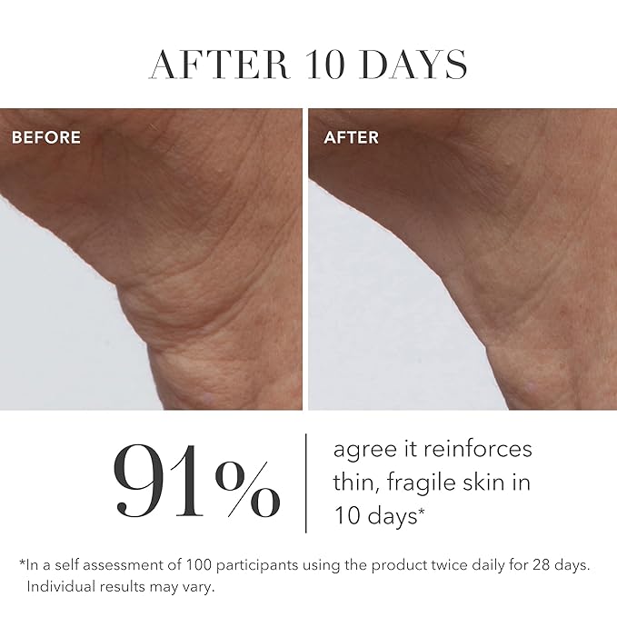 Algenist GENIUS Ultimate Anti-Aging Face Cream - Restoring Collagen Cream to Smooth, Brighten + Help Improve Skin's Radiance - Formulated with Patented Alguronic Acid and Microalgae Oil (2 oz)