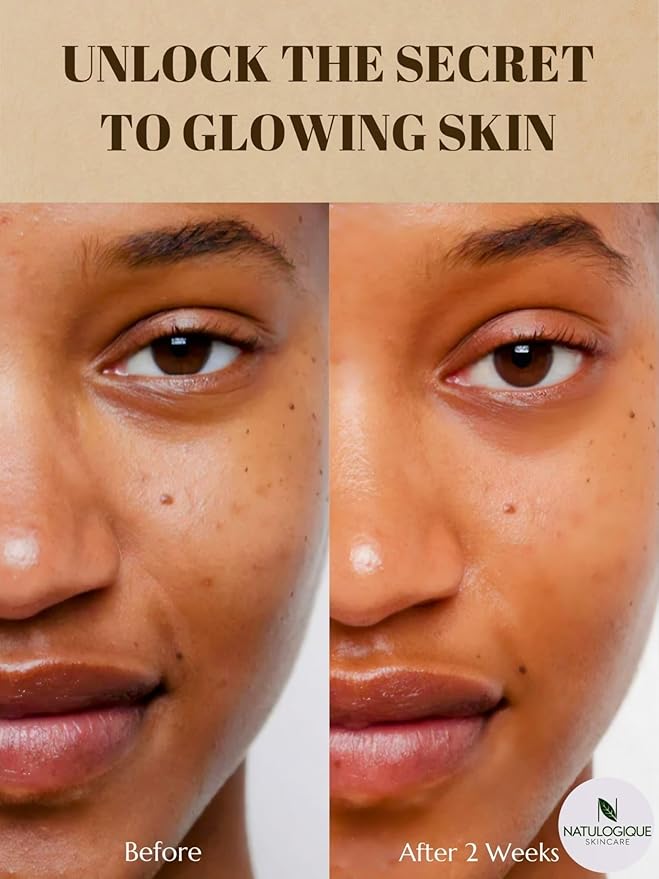 Hyaluronic Acid Serum for Face and Skin, Organic Anti-Aging Face Moisturizer for Fine Lines & Wrinkles – Vegan and Natural Skincare – 1oz (30ml) by Natulogique