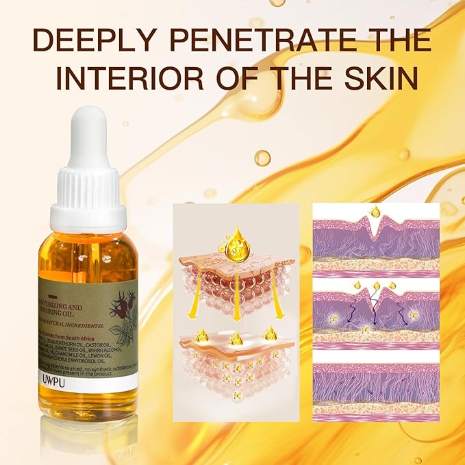 Organic Rosehip Oil, Facial Anti-Aging, Rosehip Oil for Face, for Scars, Natural Extraction of Bakuchiol, Moisturizing&Uniform Skin Tone, for all Skin Types- 30ML