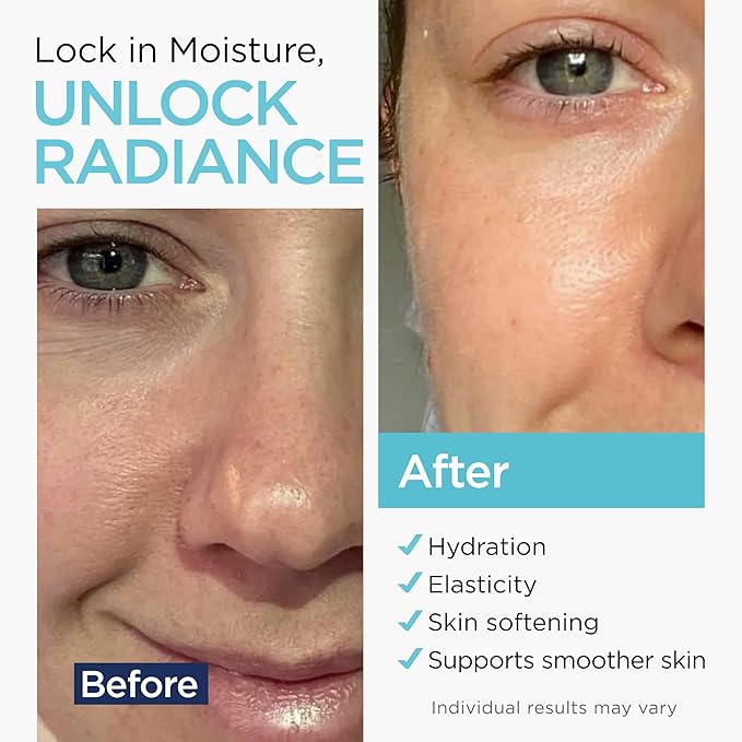 Hyaluronic Acid Serum for Face (8 Oz) for Skin and Lips - Hydrating & Moisturizing Serum for All Skin Types, Paraben-Free & Fragrance-Free