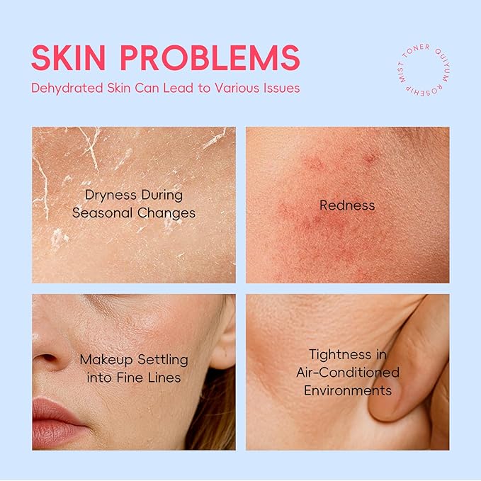 Rosehip Skin Care Set, Beauty Skincare Gift Sets, Natural Facial Skin Care Products, Korean Style Skincare for Women, Nourishing, Hydration, Glow Up, 3PCS