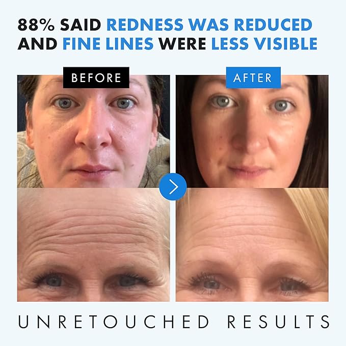 Eclat Skincare Hyaluronic Acid Serum for Face – 2.5% Hyaluronic Acid + 3% B5, Vitamin C & E - Hydrating Anti Aging & Anti Wrinkle Face Serum - Moisturizing & Plumping Formula for Smooth Skin 1 fl oz