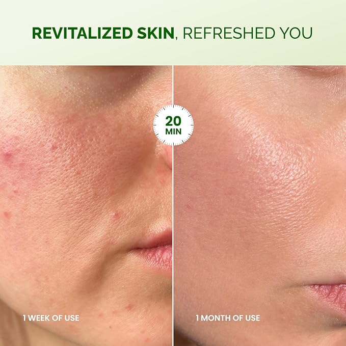 PLANTIFIQUE Facial Sheet Mask Chill Cica 5 Pack – Calming & Soothing Face Mask Sheets with Centella & Niacinamide – Korean Skincare for Skin Comfort and Even Texture