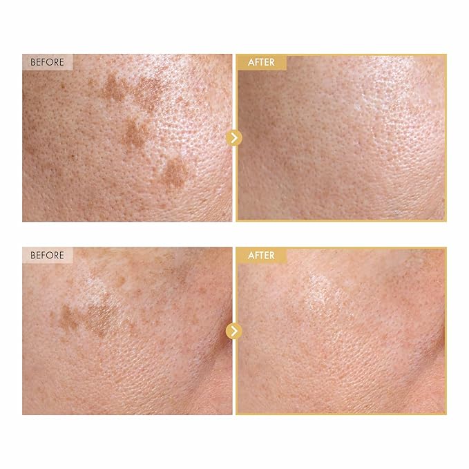 TOSOWOONG Black Snail Ginseng Serum, Ginseng 640,430ppm, Snail Mucin, Hydrating Facial Moisturizer, Acne Scar Remover, Self Care, Glow Skin Under Makeup, Korean Skin Care, 30ml, 1.01 fl. oz.