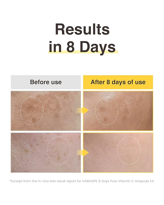 VARIHOPE 8 Days Vitamin C Serum - High-Potency Ascorbic Acid for Brightening, Dark Spot Care & Even Skin Tone, Korean Skin Care Ampoule for Glowing, Radiant Skin, 0.5 fl oz