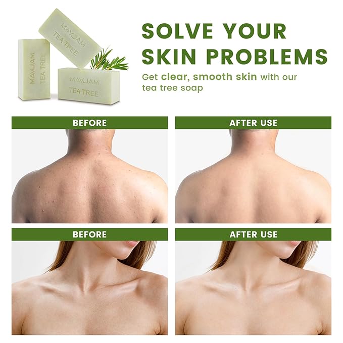 MAYJAM Tea Tree Oil Soap Bar, Natural Botanical Tea Tree Bar Soap with Vitamin E, Pure Plant Oil Bath Soap for Body Face Fights Acne, Tinea, Ringworm, Skin Itch Irritation and Prevents Breakouts