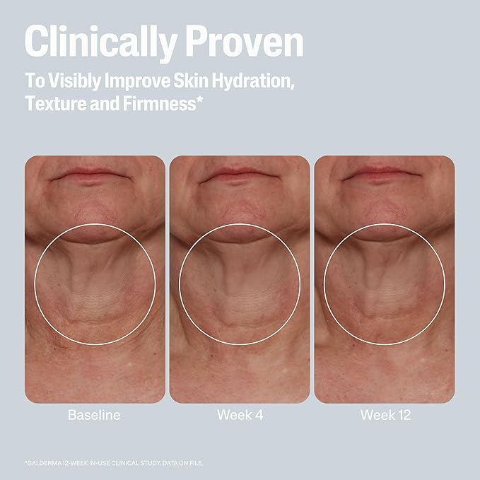 Cetaphil Skin Activator Hydrating & Firming Cream For Face, Neck & Chest 3.4 oz, Mandelic Acid (AHA) and Centella Asiatica (CICA) Cream, Hydrates and Firms Aging Skin, Anti-Aging Skincare