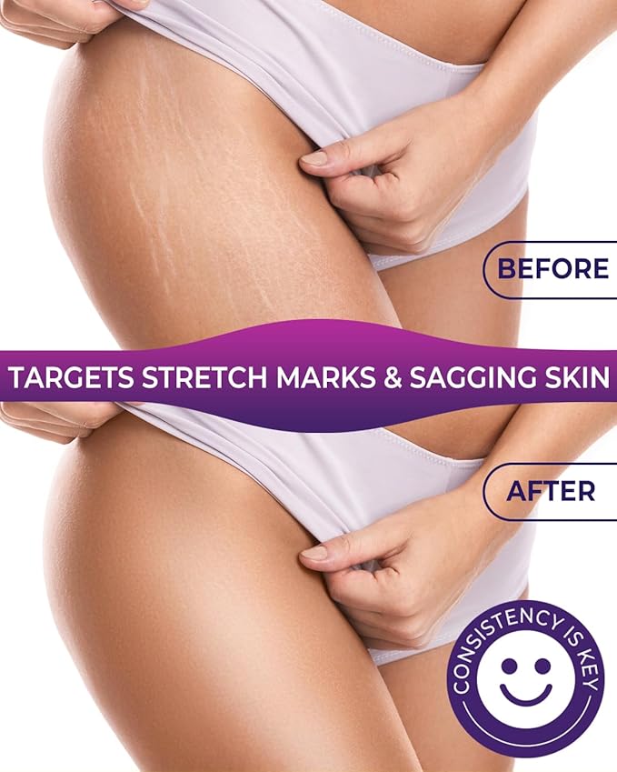 Body Firming Oil, 3.4 FL OZ Body Oil After Shower – With 790,000ppm Tightening Oil(Grape Seed Jojoba Sweet Almond) &10,000ppm Hyaluronic Acid – Fast-Absorbing For Hydrating Full Body, Lavender