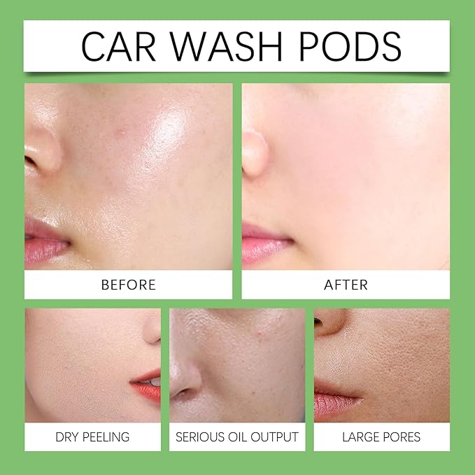 Aloe Vera Gel – Soothing and Hydrating Gel for Face and Body – Organic Aloe Vera Gel for Dry, Sensitive, and Acne-Prone Skin