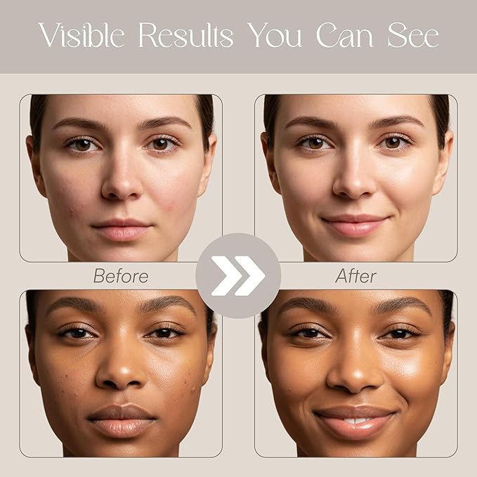 CloudSkin Astaxanthin Egg Mask, Overnight Hydrogel Sleeping Mask, Hydrating Face Mask with Hyaluronic Acid, Squalane & Aloe Vera, Soothing & Brightening, 5 Single-Use Pods