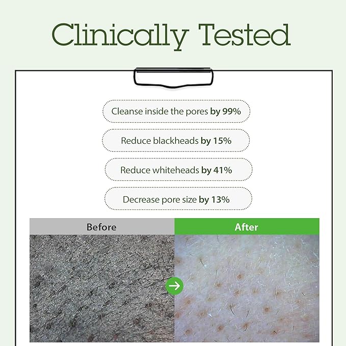 BLITHE Cleansing Balm, Pore Cleansing Makeup Remover Balm, Hygenic Design, Korean Makeup Remover