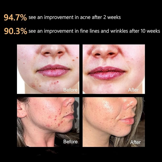 FDA cleared LED Facial Skin Care Mask MOONLIGHT PRO 7 Color Treatment Photon Mask (White)