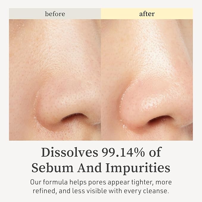 NOONI Top Pick Set – LHA Cleansing Oil & Applepeony LO & Appletea Lip Oil