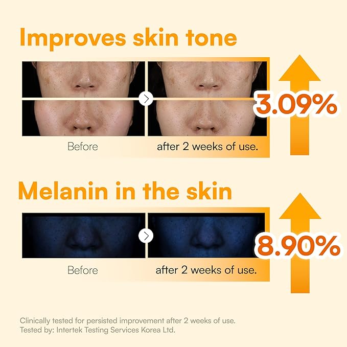 Face Republic Vita Radiance Niacin 10 Cream 50ml 1.69 fl oz | Revitalizing, Natural Coverage | Niacinamide 10%, Ascorbic Acid, Panthenol, Vitamins | Silky Finish | Vegan Korean Skincare