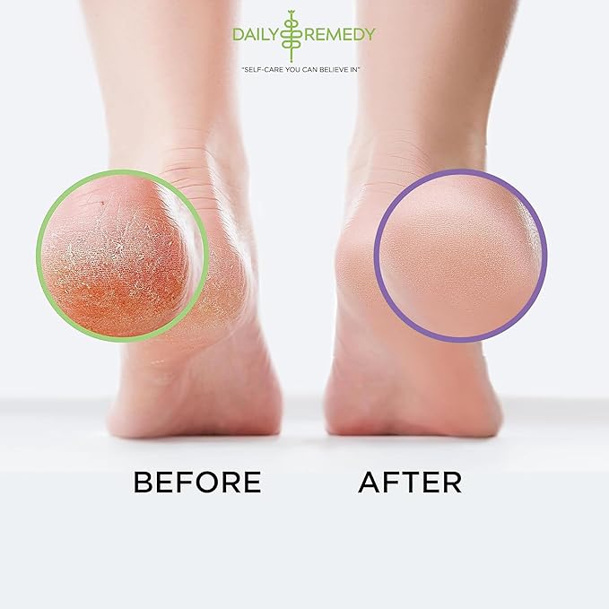 DAILY REMEDY 4-Pack - 2 Extra Strength Tea Tree Oil & 2 Calming Lavender Foot Soak Set - Made in USA - Soothes Sore Tired Feet, Athletes Foot, and Softens Calluses - 64 oz