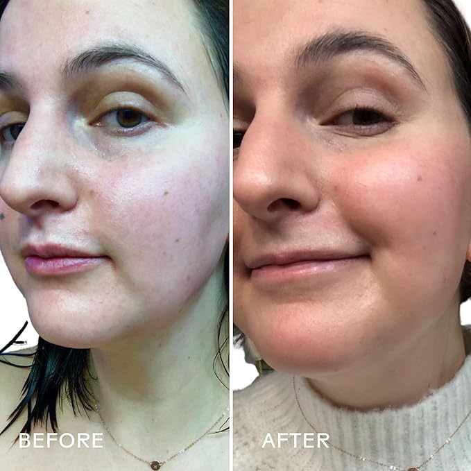 Three Ships - Boost 49% Rosehip Oil Serum | Moisturize, Firm, Plump Skin | Cruelty-Free, Vegan, Paraben-Free, Sensitive Skin Safe (1 fl oz | 30 mL)