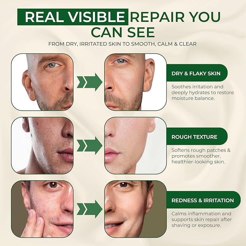 Men's Skin Repair Balm – Face & Body For All Skin Types – Soothes Acne, Sunburn, After Shave & Redness – With Sunscreen – Ember Citrus Scent, 2oz