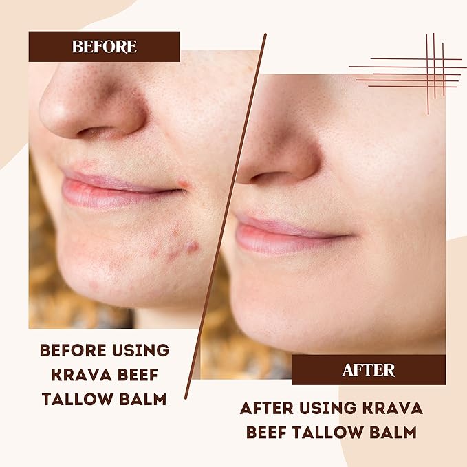 Beef Tallow for Skin, Beef Tallow for Face, Whipped Tallow Balm, Beef Tallow Moisturizer - Tallow Face Moisturizer, Tallow Cream | 100% Grass Fed, Unscented, 2 oz