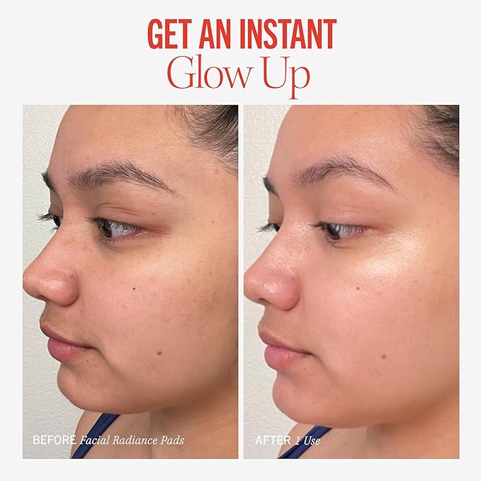 First Aid Beauty - Facial Radiance Pads with Glycolic & Lactic Acids, Daily Exfoliating Pads with AHA, Visibly Smaller Pores, Help Tone & Brighten Skin, One-Step Makeup Prep, Compostable, 28