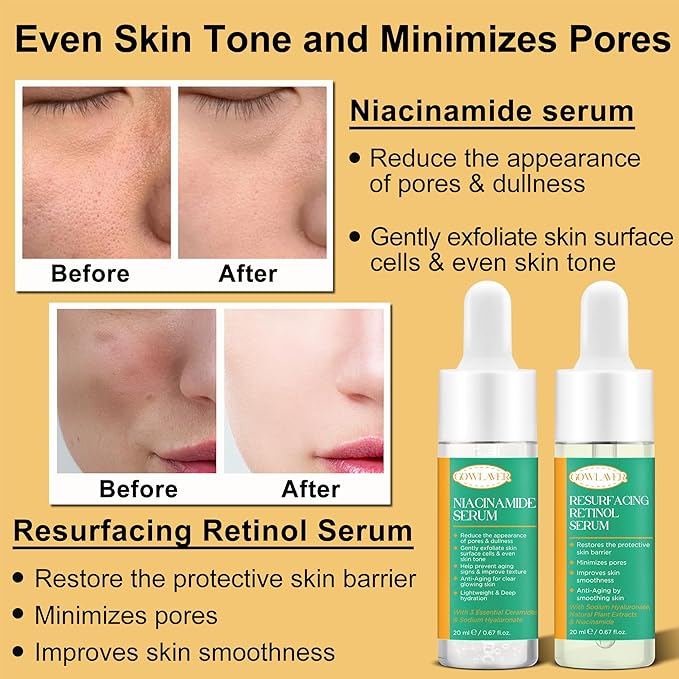 Skin Care Set for Women Teen 6 Pcs - Hydrating & Anti-Aging Facial Routine Skincare Products,Cleanser,Toner,Retinol Serum,Niacinamide Hyaluronic Acid Serum & Face Cream - Gifts Women Christmas